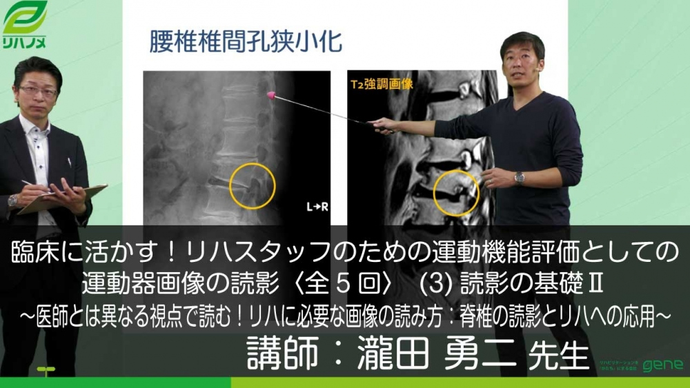 5 3 臨床に活かす リハスタッフのための運動機能評価とし 配信動画一覧 リハノメ 株式会社gene コメディカル向けセミナーと介護保険事業 出版事業