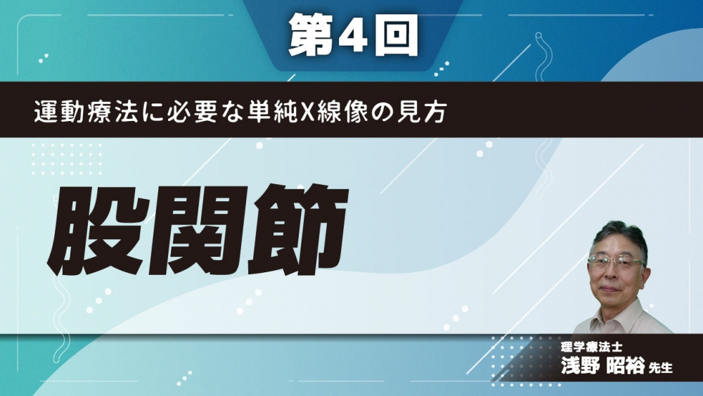 第4回】運動療法に必要な単純X線像の見方 股関節 | 配信動画一覧