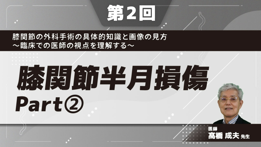 第2回】膝関節の外科手術の具体的知識と画像の見方〜臨床で... | 配信