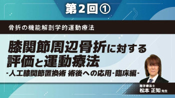 骨折の機能解剖学的運動療法 【第2回】膝関節周辺骨折に対する評価と運動療法‐人工膝関節置換術 術後への応用‐臨床編‐ Part①大腿骨遠位部骨折に対する評価と運動療法Ⅰ